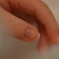 finger