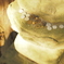 donguri