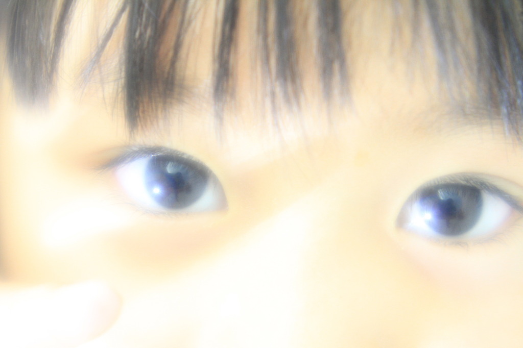 瞳
