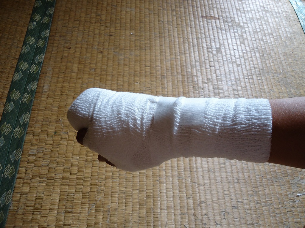 骨折り損