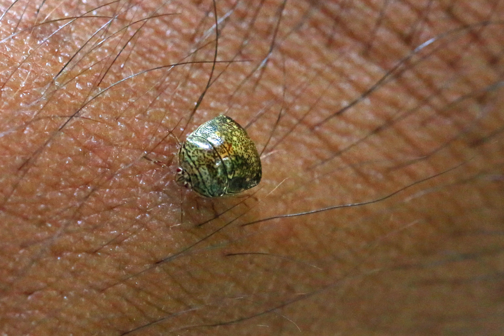 ほくろじゃないよ