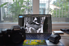 MRI
