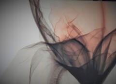 モヤモヤ症候群＊＊＊