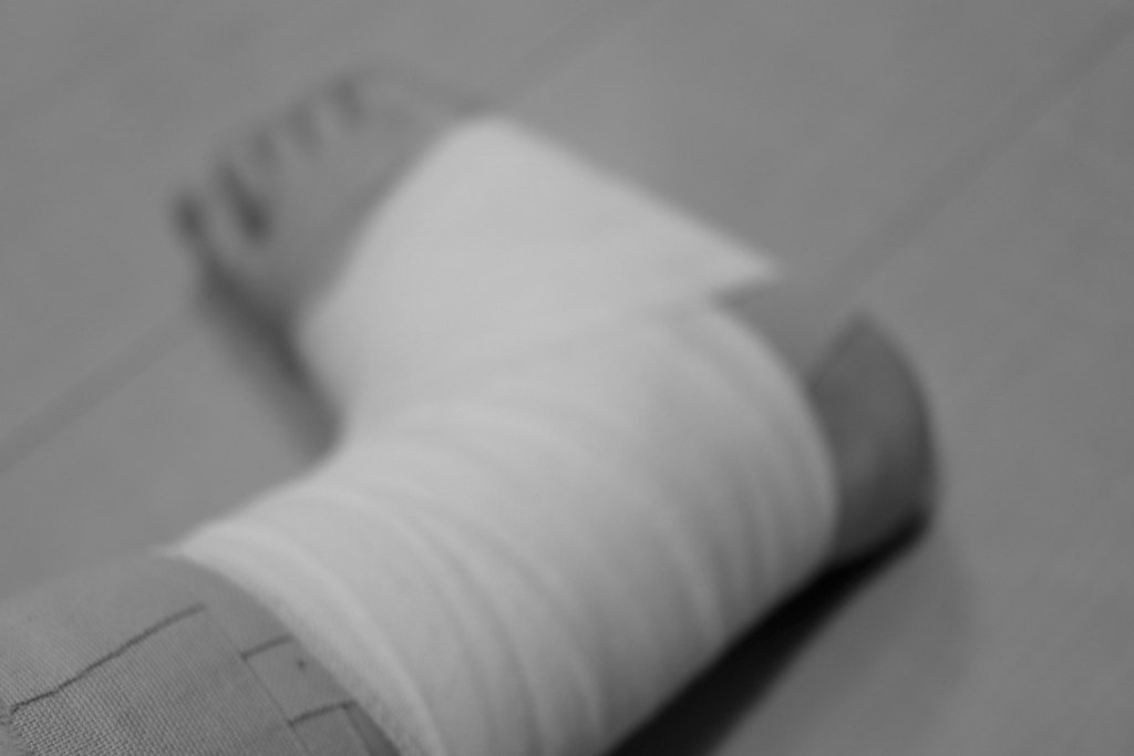 捻挫（自撮り）