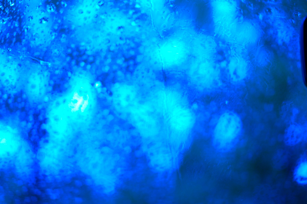 Blue　window