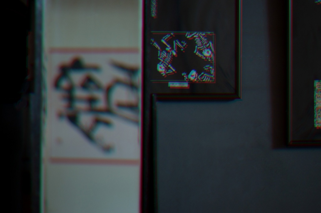 ガイコツの錯覚