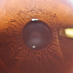 My eye
