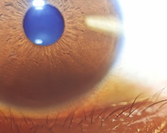 My eye