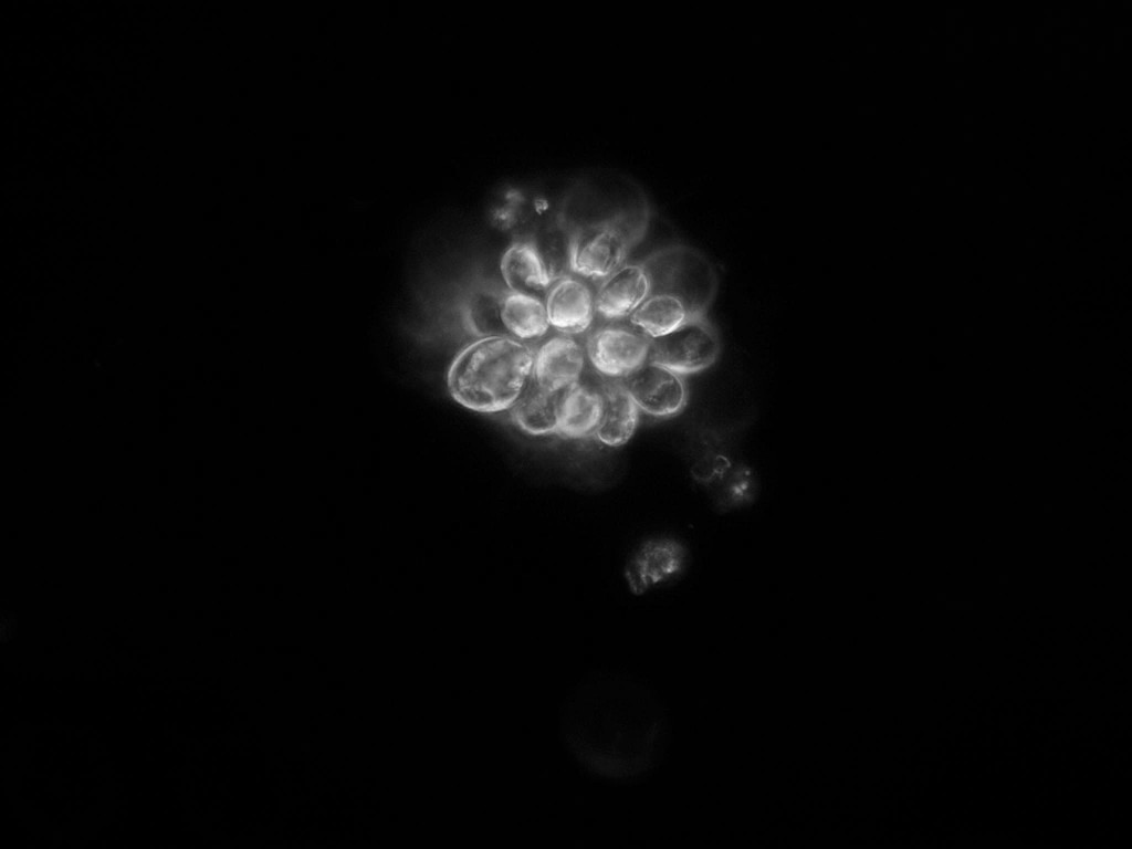 顕微鏡写真　プランクトン