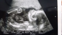 baby04