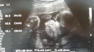 baby05