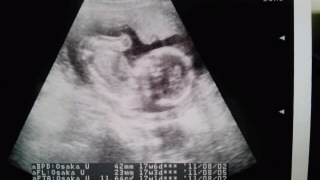 baby03
