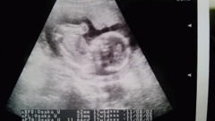 baby03
