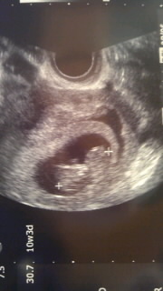 baby02