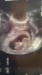 baby02