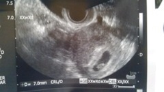 baby01