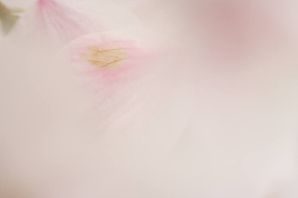 痛み