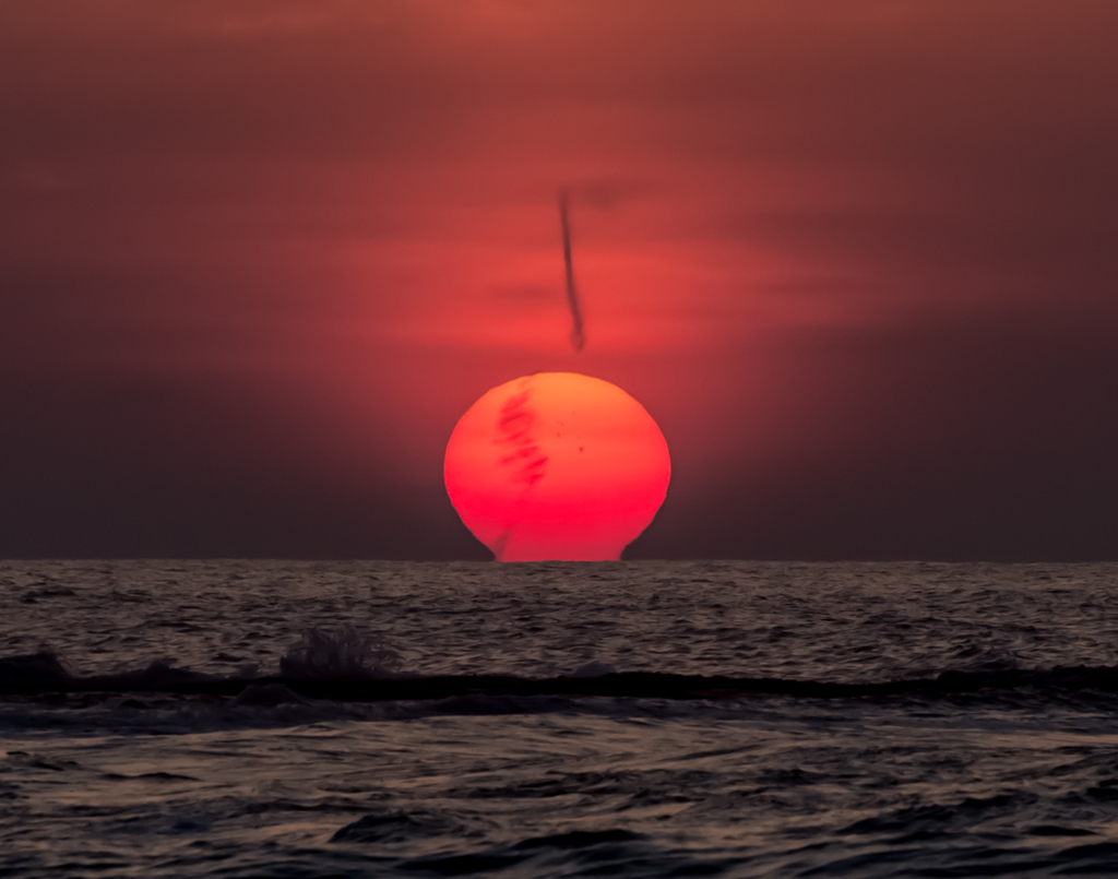 怒った磯野波平さんの頭と毛　怒り収まりつつ