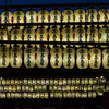 京都　八坂神社　南楼門