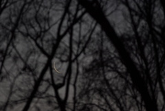 ムーンフェイス