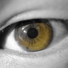 goldeneyes