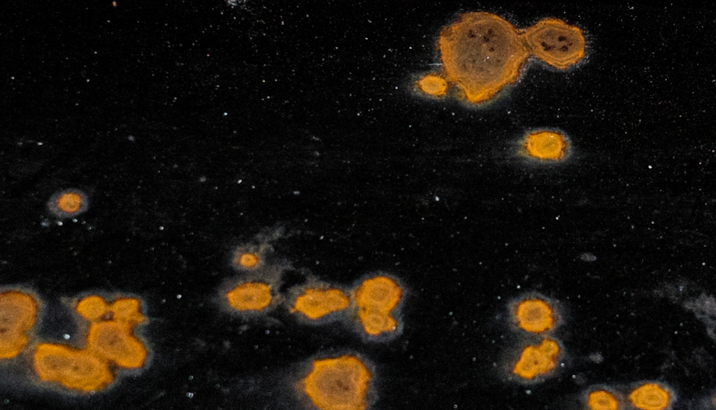 コロナウイルス