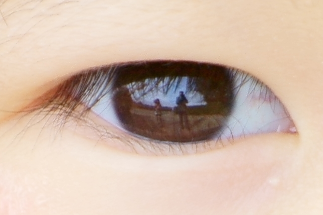 in your eye