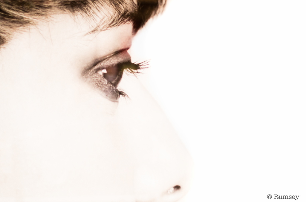 blurry eye