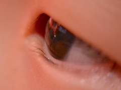 Eye…