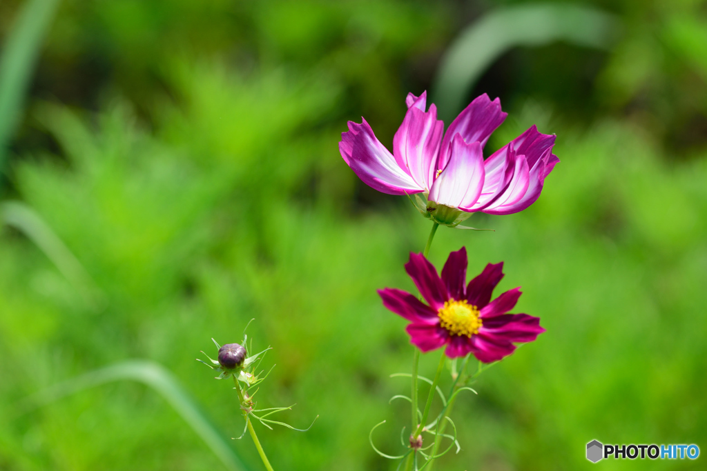 異性一卵性双生児