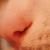 Cat nose