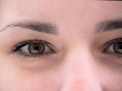 癒しのまなざし